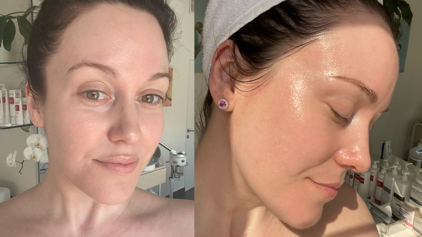HydroChill Mask - Reusable Cooling & Relief Mask